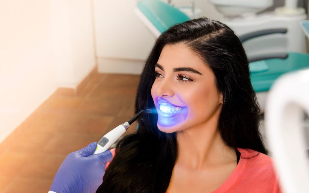 Should You Get Professional Whitening?